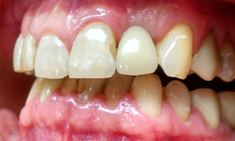 dental